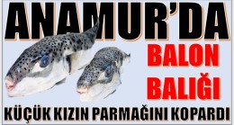 BALON BALIĞI,KÜÇÜK KIZIN PARMAĞINI KOPARDI