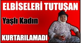Bir Anda Elbiseleri Tutuşan Kadın Kurtarılamadı